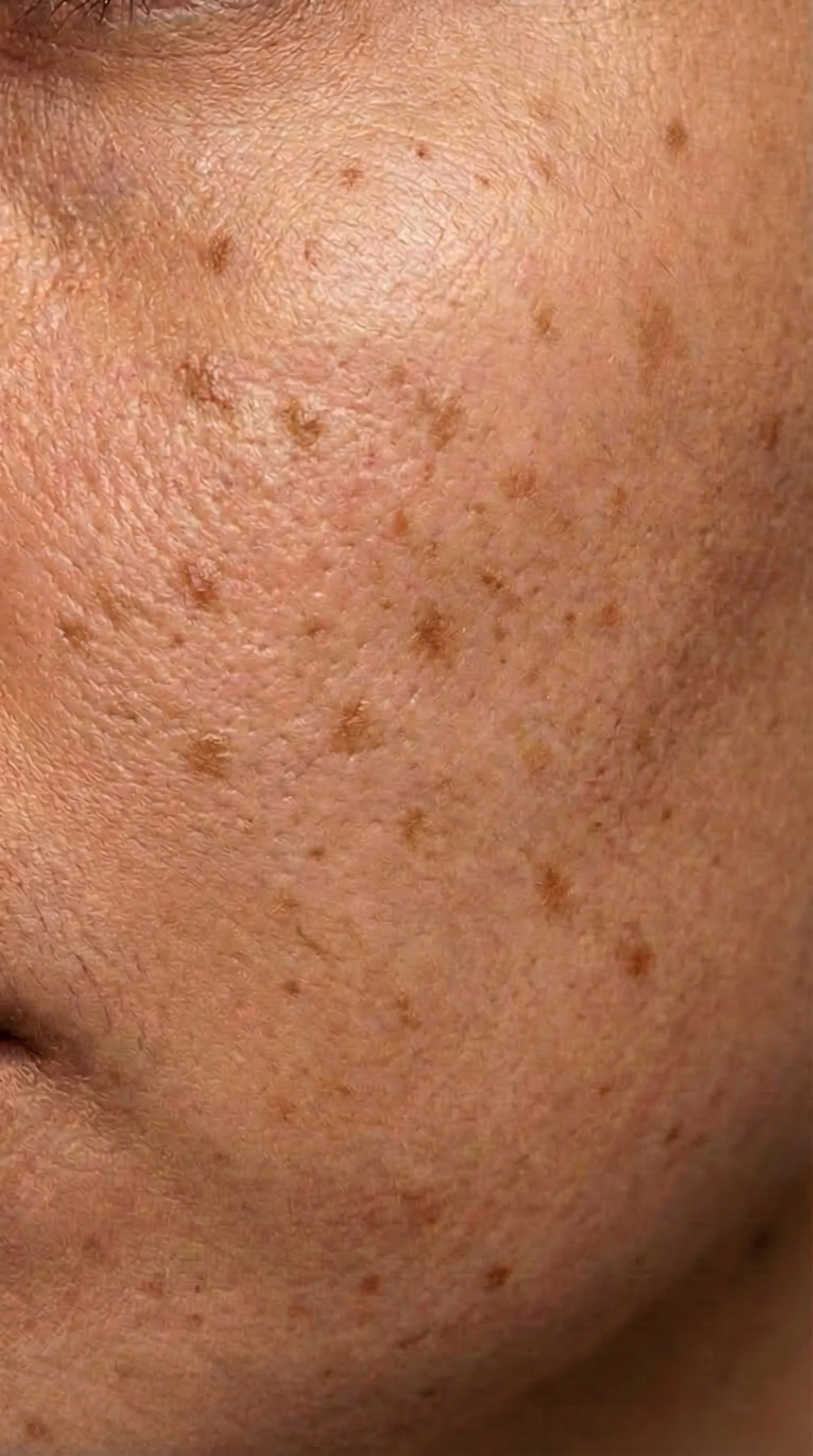 Woche 5 - Sichtbare Veränderung